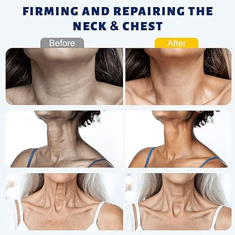 ✨Tiworld™ Instant Neck Lift Cream  — 🧴 Infused with Retinol & Hyaluronic Acid | Firms the Neck, Reduces Wrinkles & Double Chin