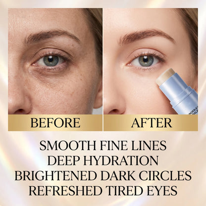 ✨ Korean Collagen Eye Miracle Stick  Wake Up Looking 10 Years Younger In Seconds 👀